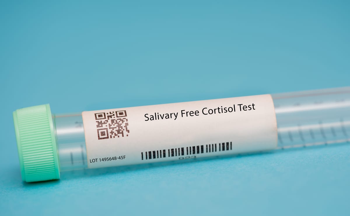 Monitoring players with salivary tests