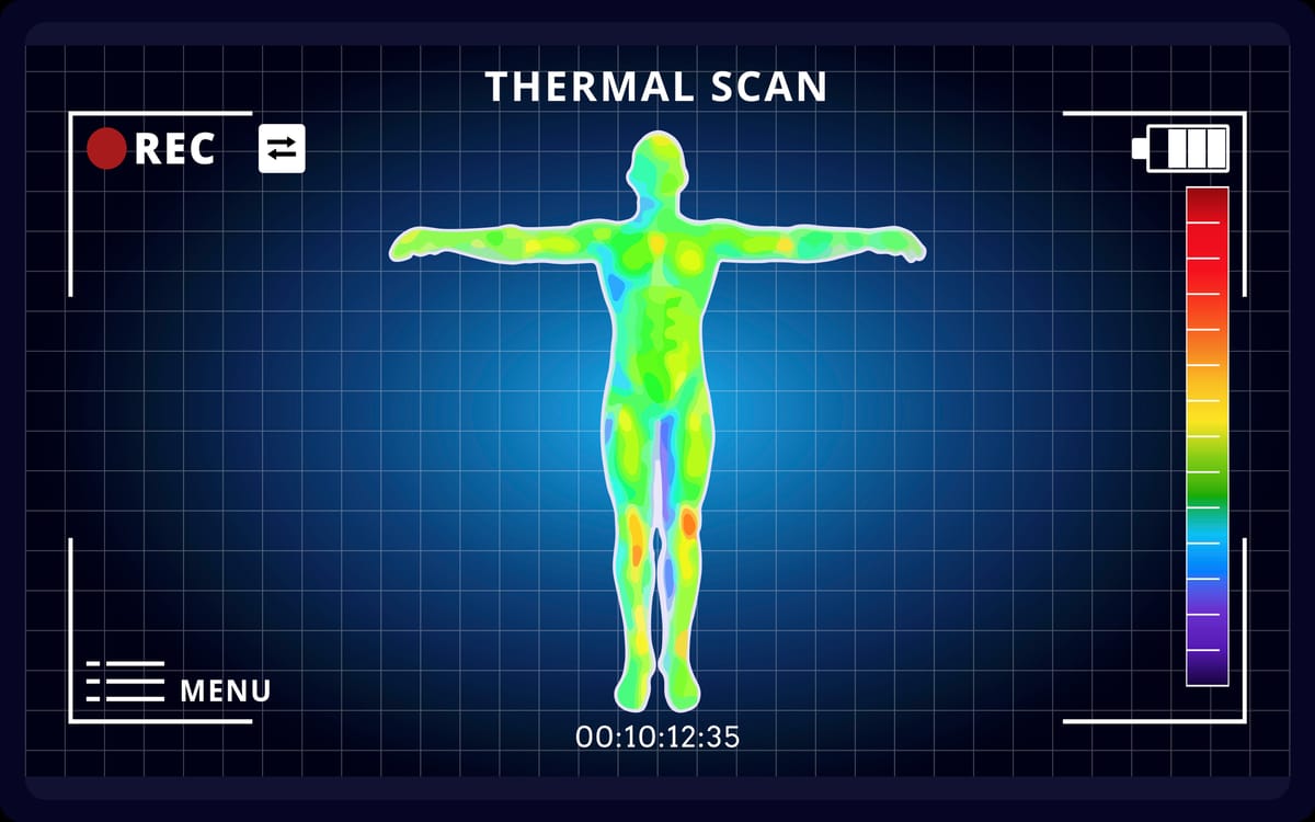 Infrared Thermography