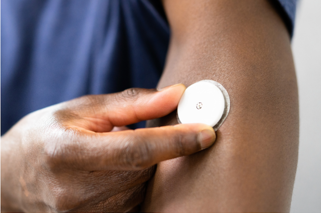 Glucose Tracking in Sports